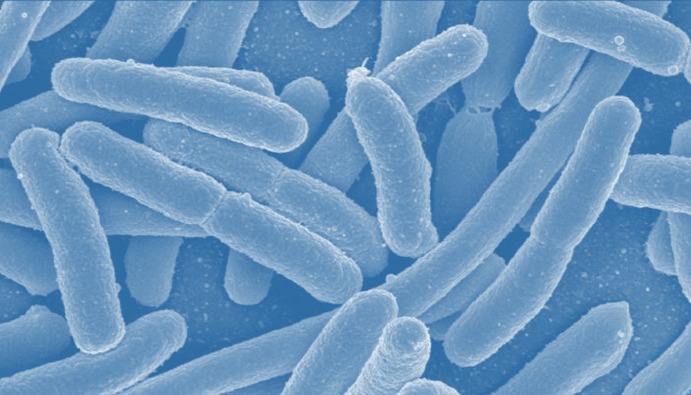 Escherchia coli Aranması
