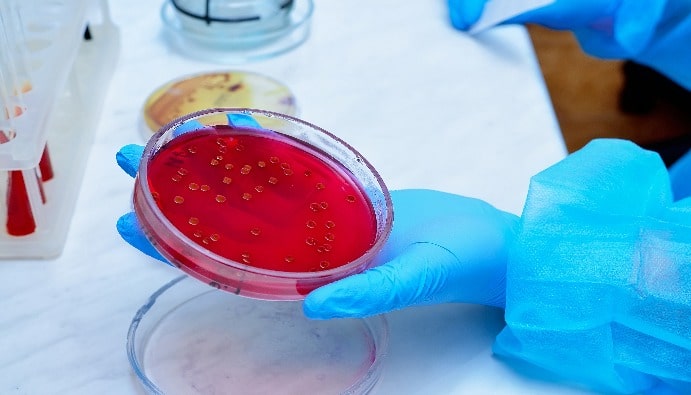 Aerobic Colony Count: Bacterial Load and Microbial Quality
