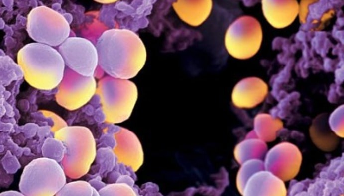Food Safety: Staphylococcal Enterotoxin Detection