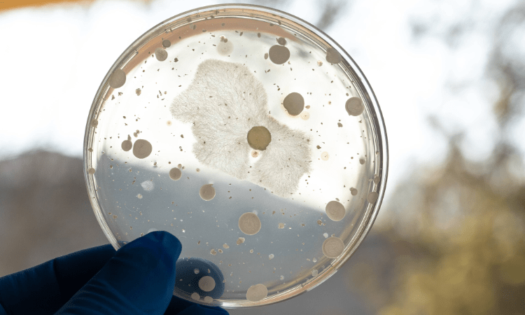 Laboratoriumbacteriekweek: Microbiële analyse en identificatiemethoden