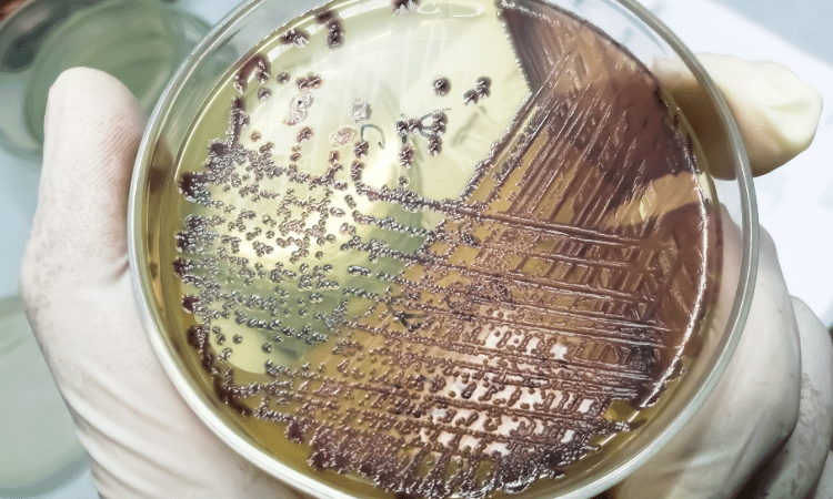 Microbiologische voedselanalyse: Bacteriën- en schimmelgevaar