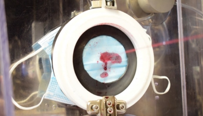 Bioburden Test: Safety and Biocompatibility Assessment