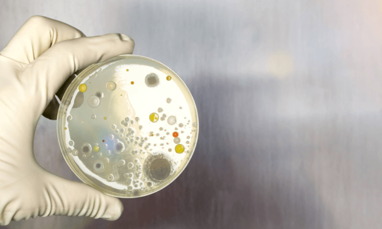 Wat is microbiologische voedselanalyse, waarom wordt het gedaan?